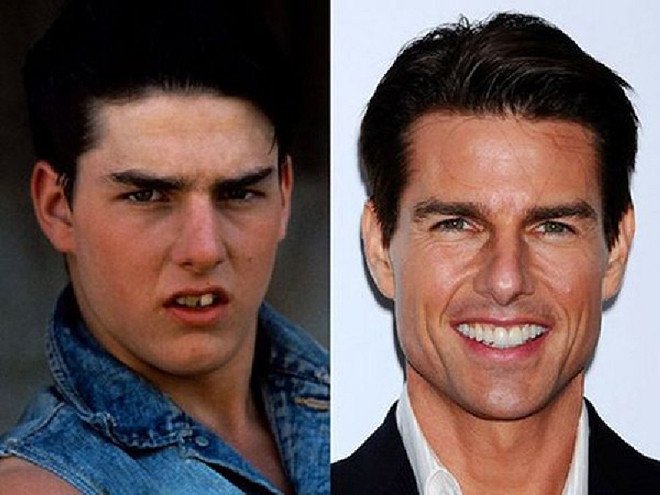 До и после изменения зубов, Фото: кадр из фильма/Getty